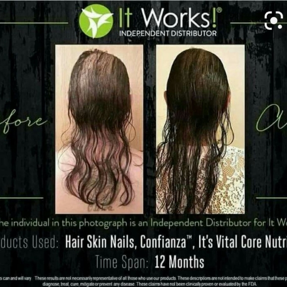 Hair skin nails - Picture 3 of 3